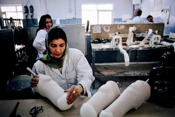 ICRC Afghanistan female prosthesis